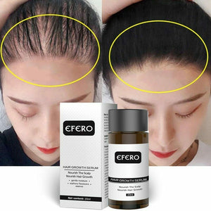 EFERO Hair Growth Serum 20ml / .67oz